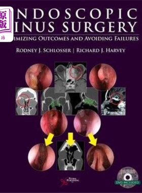 海外直订医药图书Endoscopic Sinus Surgery 内窥镜鼻窦手术