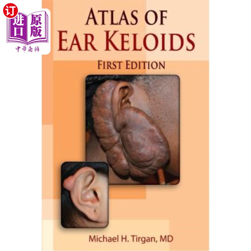 海外直订医药图书Atlas of Ear Keloids 耳瘢痕疙瘩图集