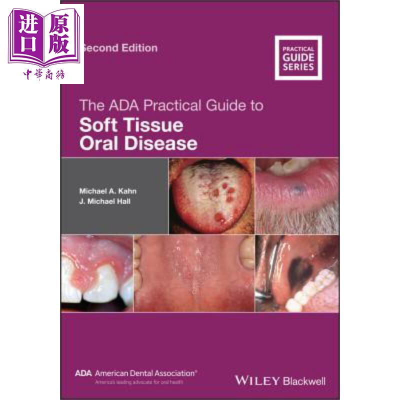 美国牙医学会软组织口腔疾病实用指南 The Ada Practical Guide To Soft Tissue Oral Disease 英文原版 Michael Kahn【中商?