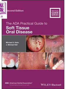 美国牙医学会软组织口腔疾病实用指南 The Ada Practical Guide To Soft Tissue Oral Disease 英文原版 Michael Kahn【中商?