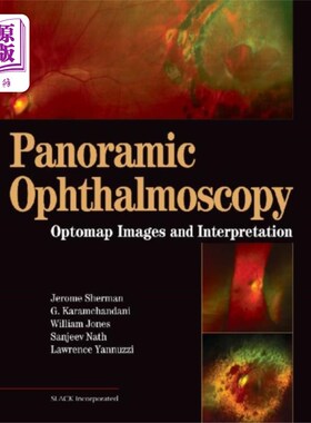 海外直订医药图书Panoramic Ophthalmoscopy 全景检眼镜检查