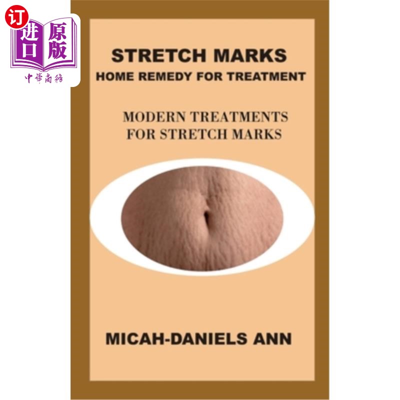 海外直订医药图书Stretch Marks Home Remedy for Treatment: Modern Treatment for Stretch Marks 妊娠纹家庭治疗方法:妊娠