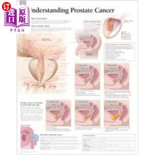 海外直订医药图书Understanding Prostate Cancer Wall Chart 了解前列腺癌挂图