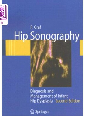 海外直订医药图书Hip Sonography: Diagnosis and Management of Infant Hip Dysplasia 髋关节超声:婴儿髋关节发育不良的诊