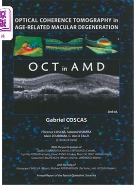 海外直订医药图书Optical Coherence Tomography in Age-Related Macular Degeneration 年龄相关性黄斑变性的光学相干断层扫描