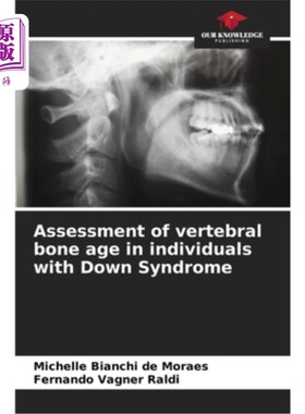 海外直订医药图书Assessment of vertebral bone age in individuals with Down Syndrome 唐氏综合征患者椎体骨龄的评估