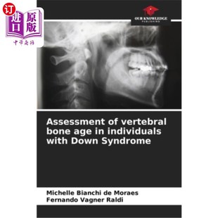 Syndrome 评估 bone individuals with vertebral age 唐氏综合征患者椎体骨龄 海外直订医药图书Assessment Down