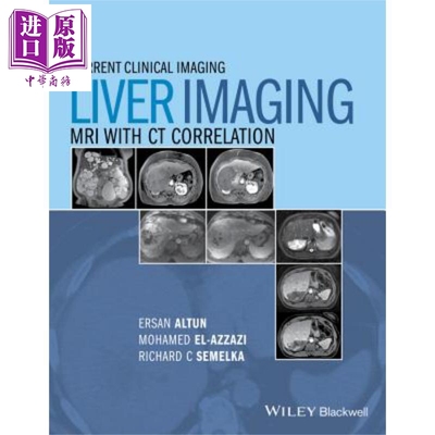 肝脏影像学检查 核磁共振成像检查与计算机断层扫描的相互关系 第2版 Liver Imaging Ersan Altun 英文原版 【中商原版】Wile
