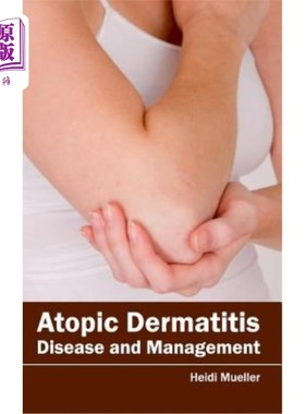 海外直订医药图书Atopic Dermatitis: Disease and Management 特应性皮炎：疾病与管理