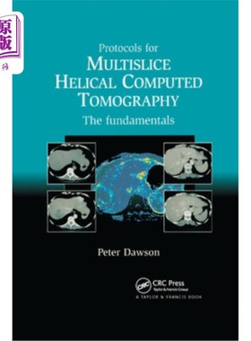 海外直订医药图书Protocols for Multislice Helical Computed Tomography: The Fundamentals 多层螺旋计算机断层扫描协议: