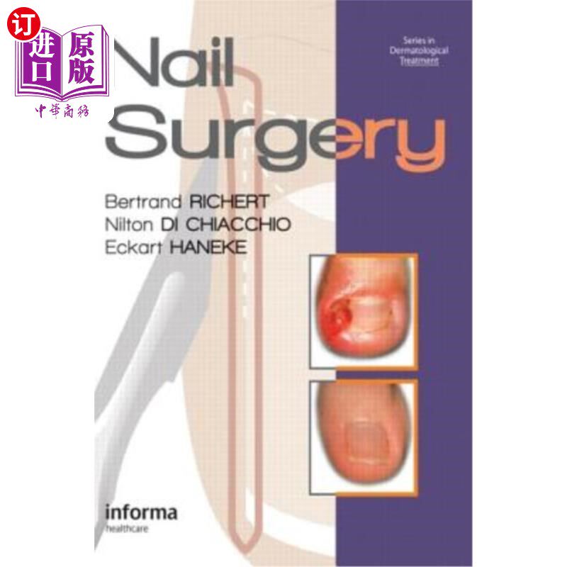 海外直订医药图书Nail Surgery 指甲手术