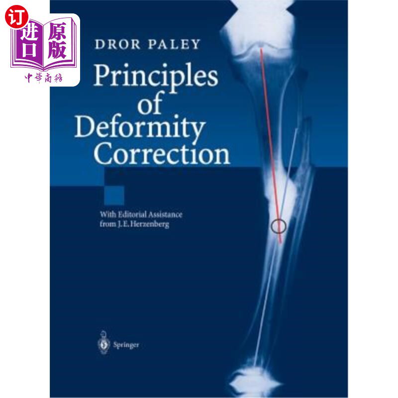 海外直订医药图书Principles of Deformity Correction 畸形矫正原则