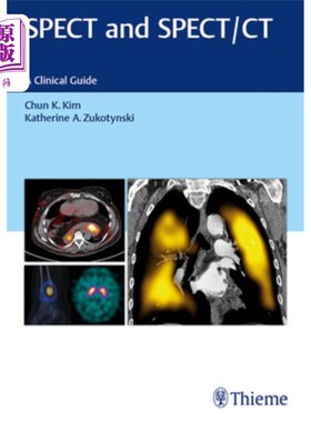 海外直订医药图书Vertigo and Disequilibrium: A Practical Guide to Diagnosis and Management 眩晕和不平衡:诊断和管理实