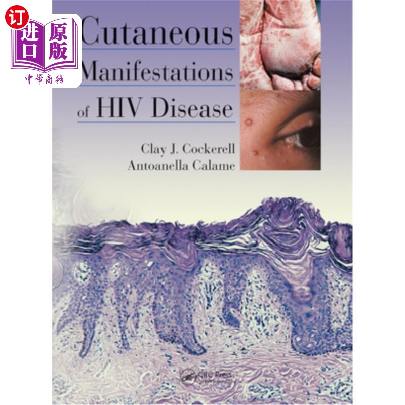 海外直订医药图书Cutaneous Manifestations of HIV Disease HIV疾病的皮肤表现