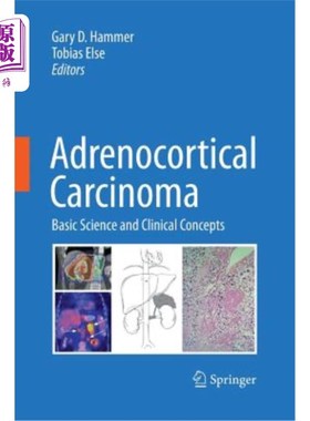 海外直订医药图书Adrenocortical Carcinoma: Basic Science and Clinical Concepts 肾上腺皮质癌：基础科学与临床概念