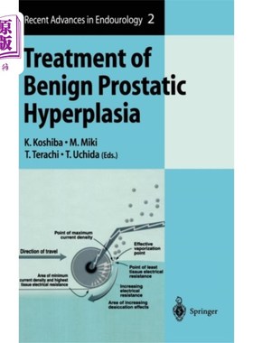 海外直订医药图书Treatment of Benign Prostatic Hyperplasia 良性前列腺增生的治疗