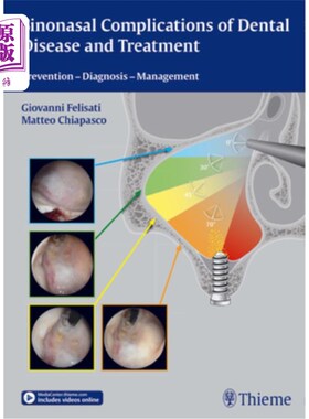 海外直订医药图书Sinonasal Complications of Dental Disease and Treatment: Prevention - Diagnosis  牙病的鼻窦并发症及
