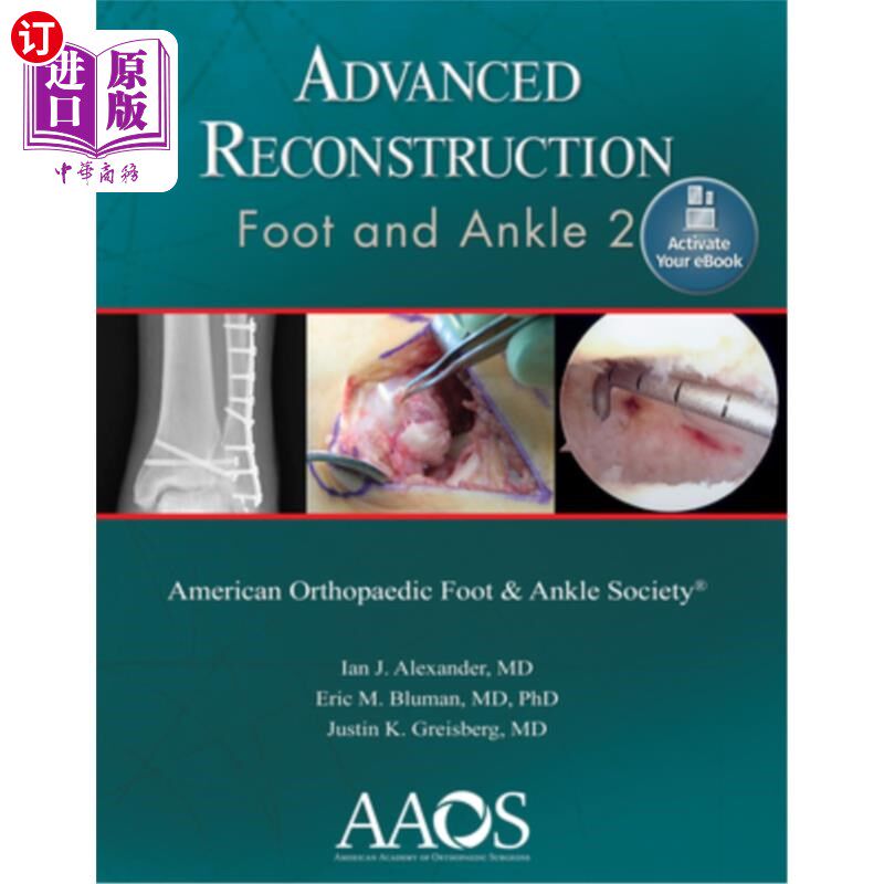 海外直订医药图书Advanced Reconstruction: Foot and Ankle 2: Print + eBook 高级重建:脚和脚踝2:打印+电子书
