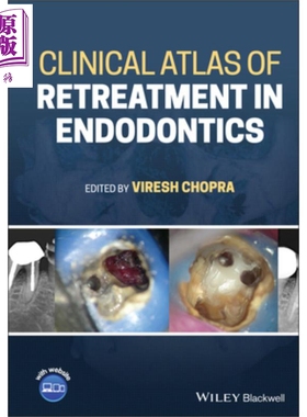现货 Clinical Atlas Of Retreatment In Endodontics【中商原版】