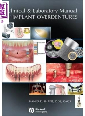 Implant Overdentures 临床与实验手册 Clinical And Laboratory Manual Of Implant Overdentures 英文原版 Hamid Shafie wi