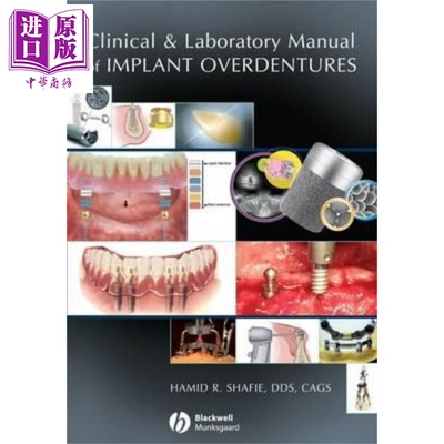Implant Overdentures 临床与实验手册 Clinical And Laboratory Manual Of Implant Overdentures 英文原版 Hamid Shafie wi