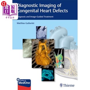 Congenital Heart 海外直订医药图书中古英语 先天性心脏缺陷 Imaging Defects 影像诊断 Diagnostic