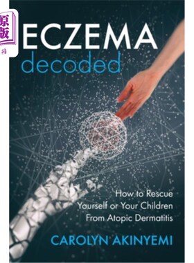海外直订医药图书Eczema Decoded: How to Rescue Yourself or Your Children from Atopic Dermatitis 湿疹解码：如何从特应