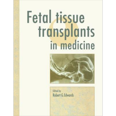 现货 Fetal Tissue Transplants in Medicine 英文原版 医学中的胎儿组织移植 Robert G. Edwards【中商原版】