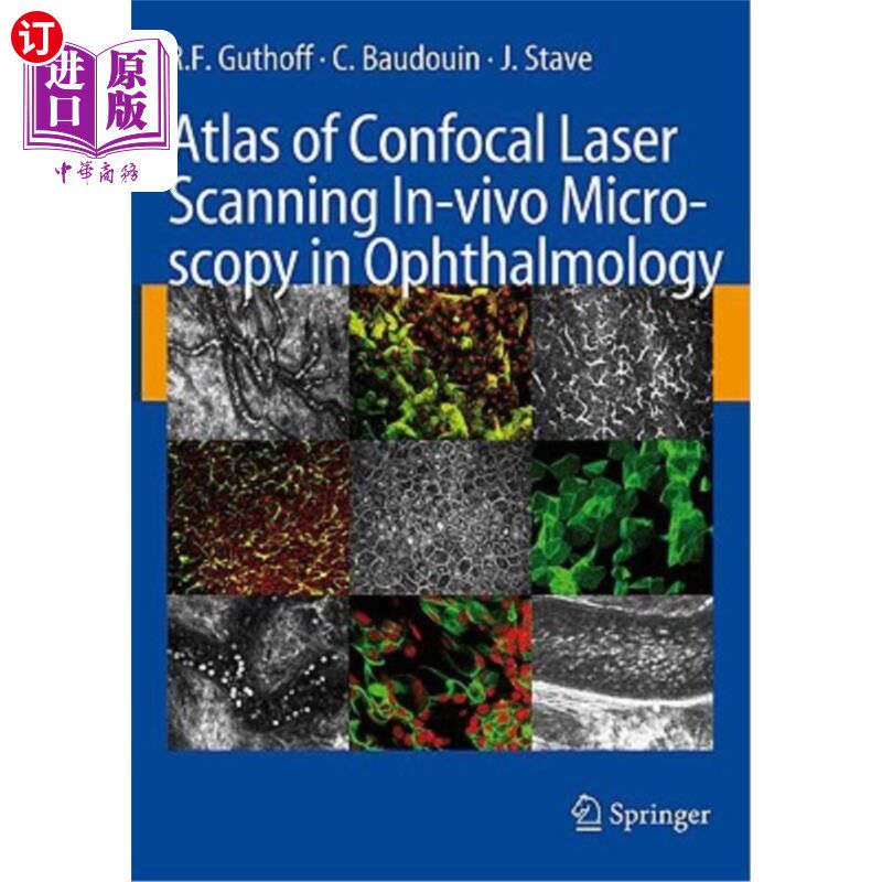 海外直订医药图书Atlas of Confocal Laser Scanning In-Vivo Microscopy in Ophthalmology: Principles 眼科共聚焦激光扫描