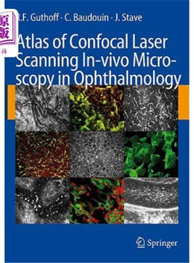 海外直订医药图书Atlas of Confocal Laser Scanning In-Vivo Microscopy in Ophthalmology: Principles 眼科共聚焦激光扫描
