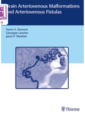 海外直订医药图书Brain Arteriovenous Malformations and Arteriovenous Fistulas 脑动静脉畸形和动静脉瘘