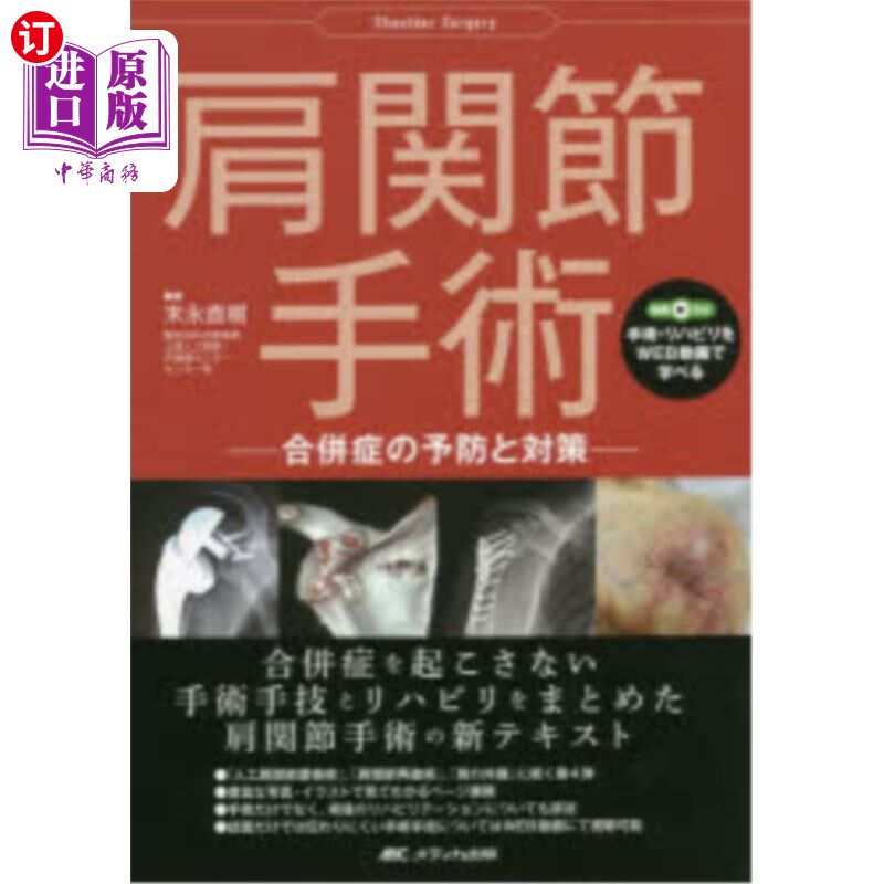 海外直订日语 肩関節手術 合併症の予防と対策 肩关节手术并发症的预防和对策