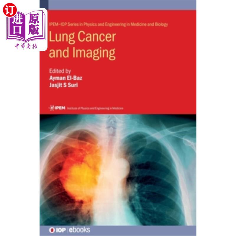 海外直订医药图书Lung Cancer and Imaging 肺癌与影像学