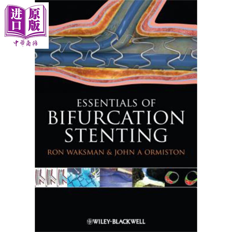 现货 分叉支架置入术的要领 Bifurcation Stenting Ron Waksman 英文原版 中商原版 Wiley【中商原版】