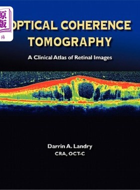 海外直订医药图书Optical Coherence Tomography a Clinical Atlas of Retinal Images 光学相干断层扫描-视网膜图像的临床图