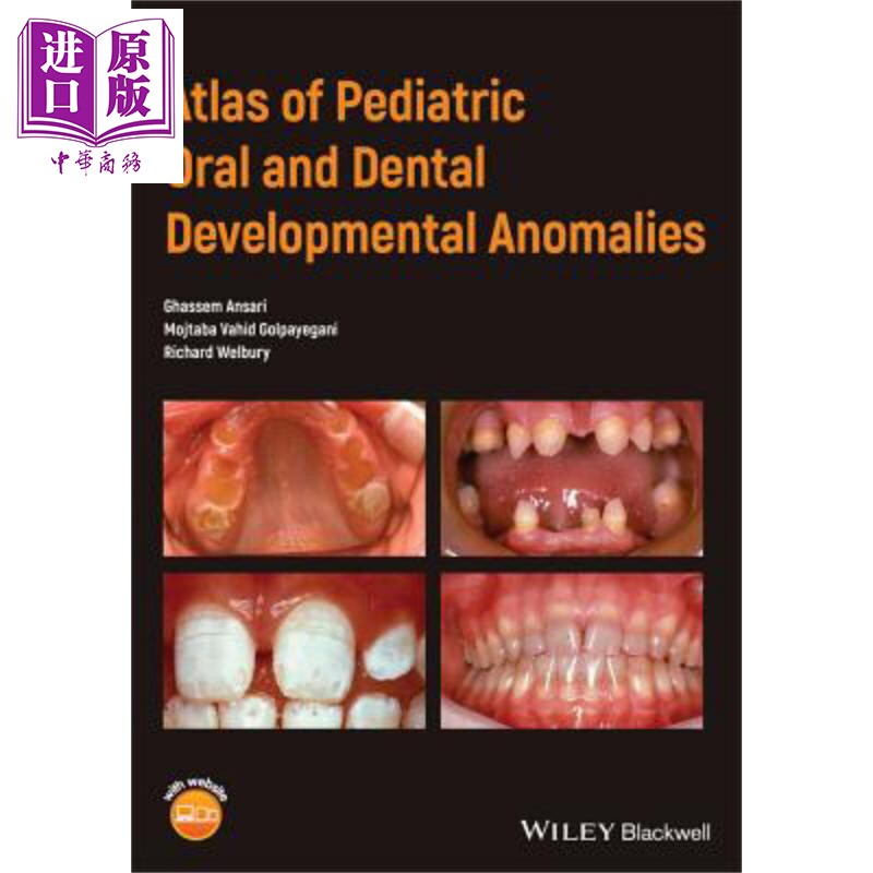 儿科口腔与牙齿发育异常图集 Atlas Pediatric Oral And Dental Developmental Anomalies 英文原版 Ghassem Ansari【中商原?