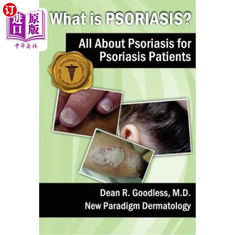 海外直订医药图书What is Psoriasis?: All About Psoriasis for Psoriasis Patients 什么是牛皮癣?:关于银屑病患者的所有
