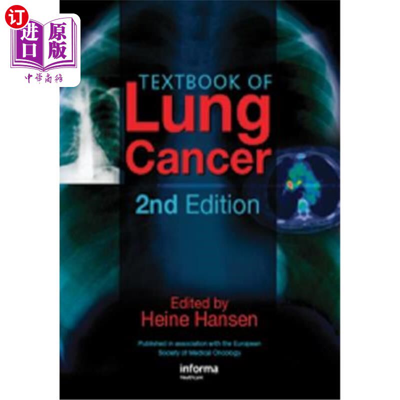 海外直订医药图书Textbook of Lung Cancer 肺癌教材