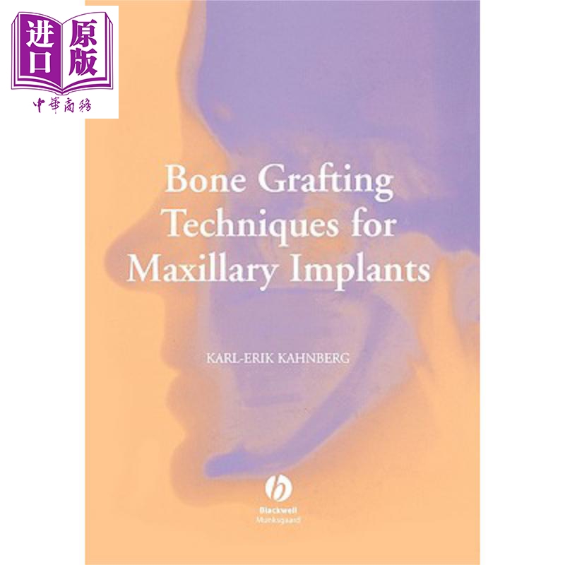 现货 上颌种植体的骨移植技术 Bone Grafting Techniques For Maxillary Implants 英文原版 Karl【中商原版】