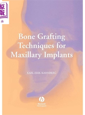 现货 上颌种植体的骨移植技术 Bone Grafting Techniques For Maxillary Implants 英文原版 Karl【中商原版】