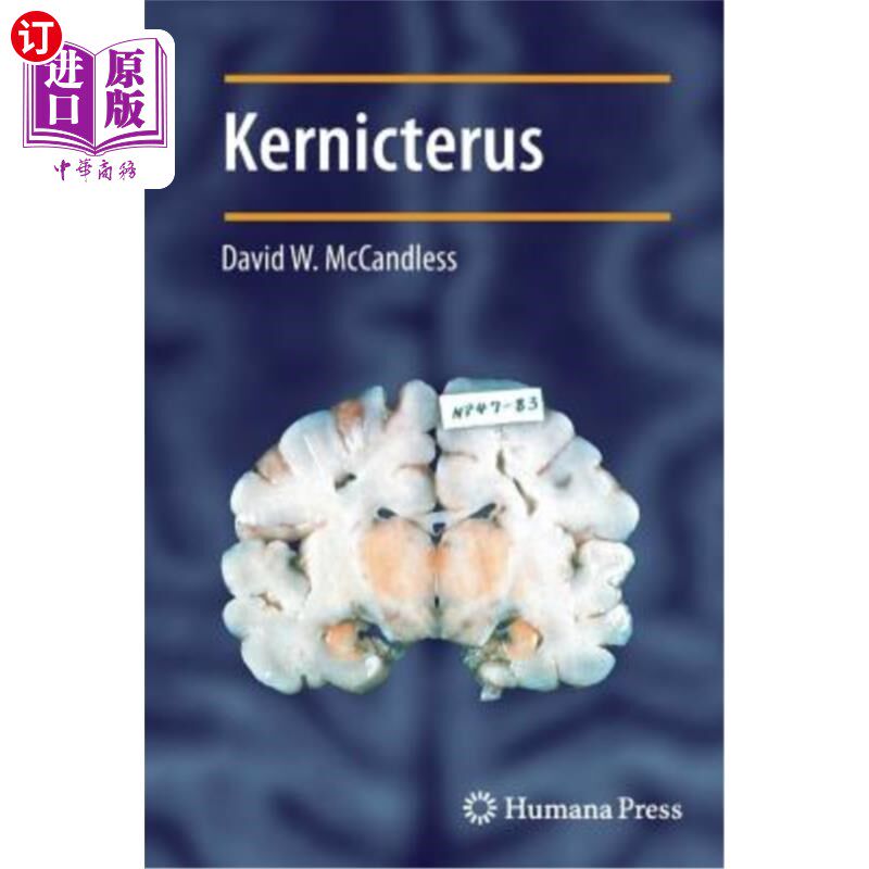 海外直订医药图书Kernicterus 核黄疽