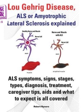 海外直订医药图书Lou Gehrig Disease, ALS or Amyotrophic Lateral Sclerosis Explained. ALS Symptoms 娄氏病，肌萎缩侧索
