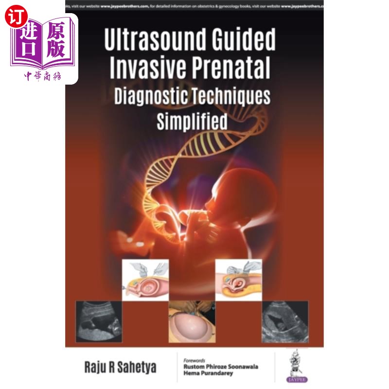 海外直订医药图书Ultrasound Guided Invasive Prenatal Diagnostic Techniques Simplified 超声引导下有创产前诊断技术