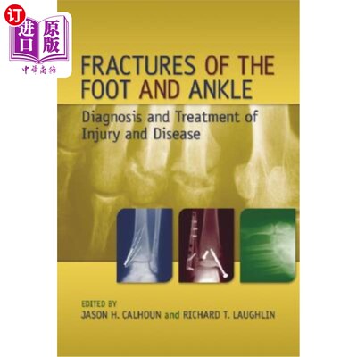海外直订医药图书Fractures of the Foot and Ankle: Diagnosis and Treatment of Injury and Disease 足踝骨折:损伤与疾病