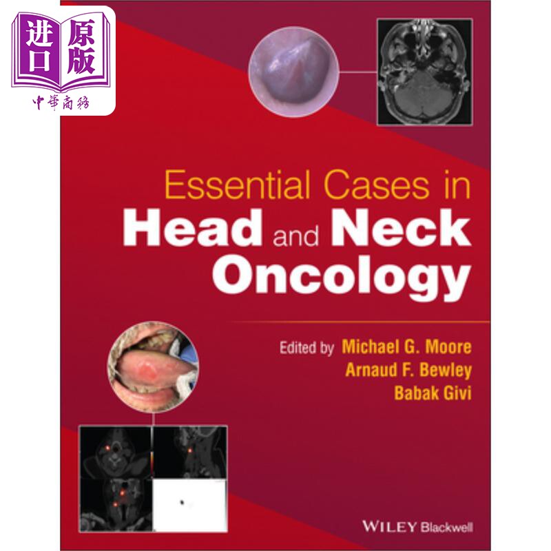 现货 头颈部肿瘤的基本病例 Essential Cases in Head and Neck Oncology 英文原版 Babak Givi 中商原版