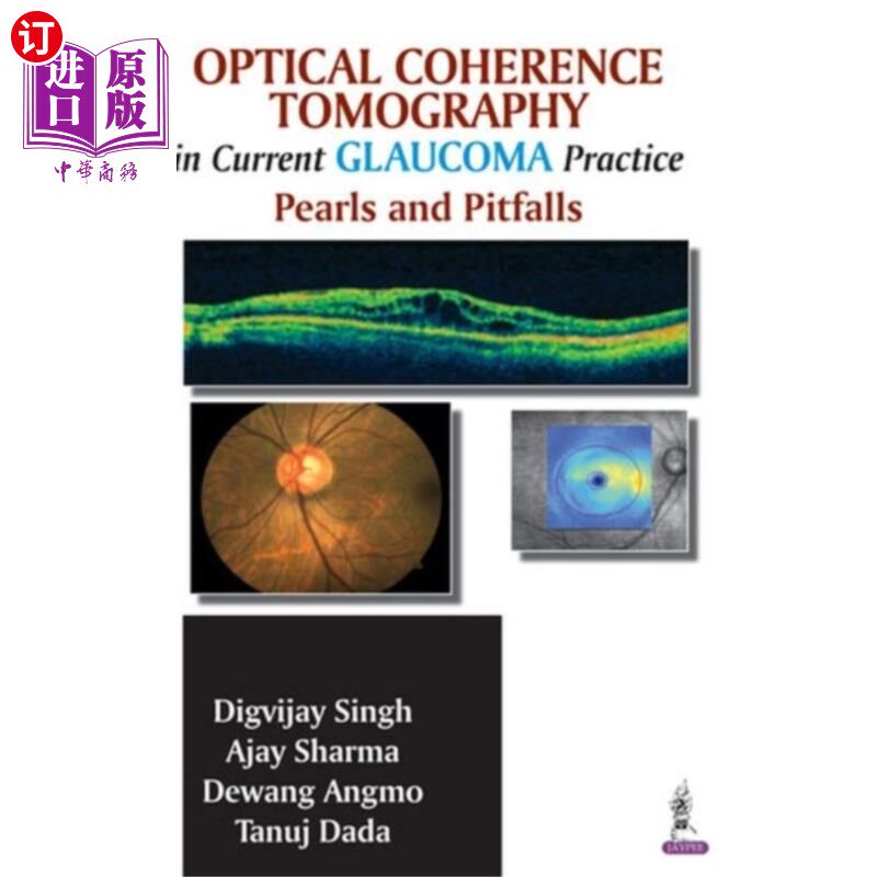 海外直订医药图书Optical Coherence Tomography in Current Glaucoma... 光学相干断层扫描在青光眼治疗中的应用