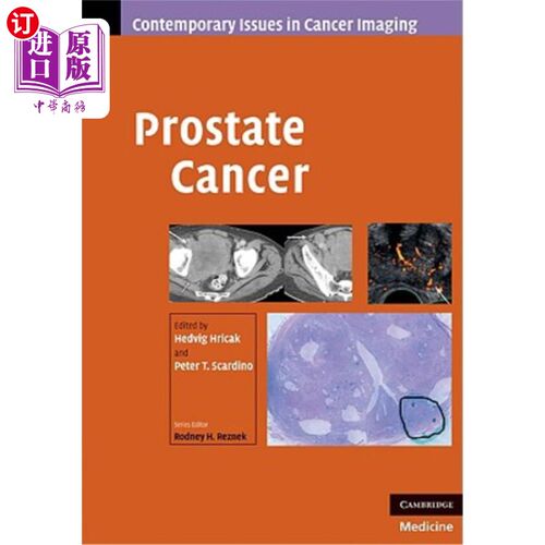 海外直订医药图书Prostate Cancer 前列腺癌