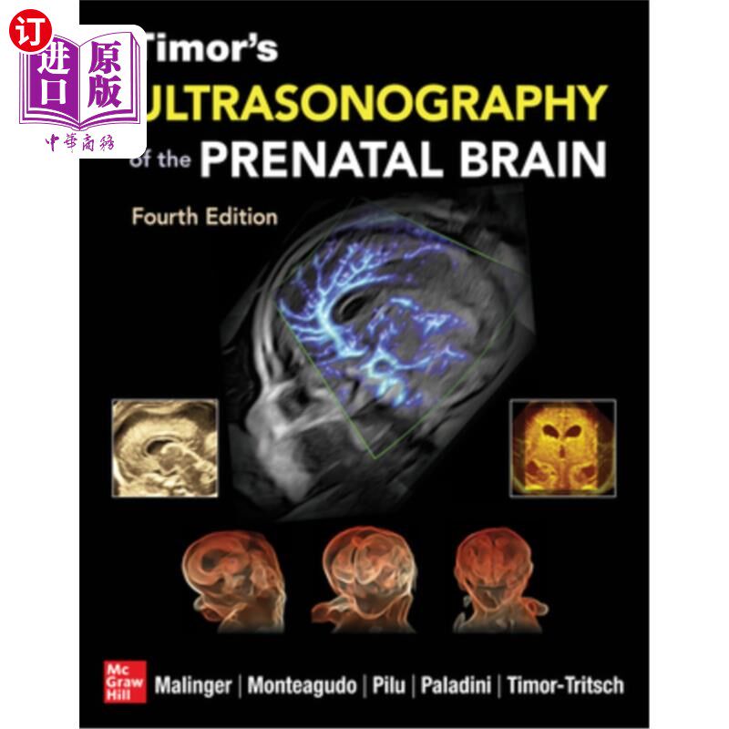 海外直订医药图书Timor's Ultrasonography of the Prenatal Brain, Fourth Edition 帝汶产前大脑的超声检查,第四版