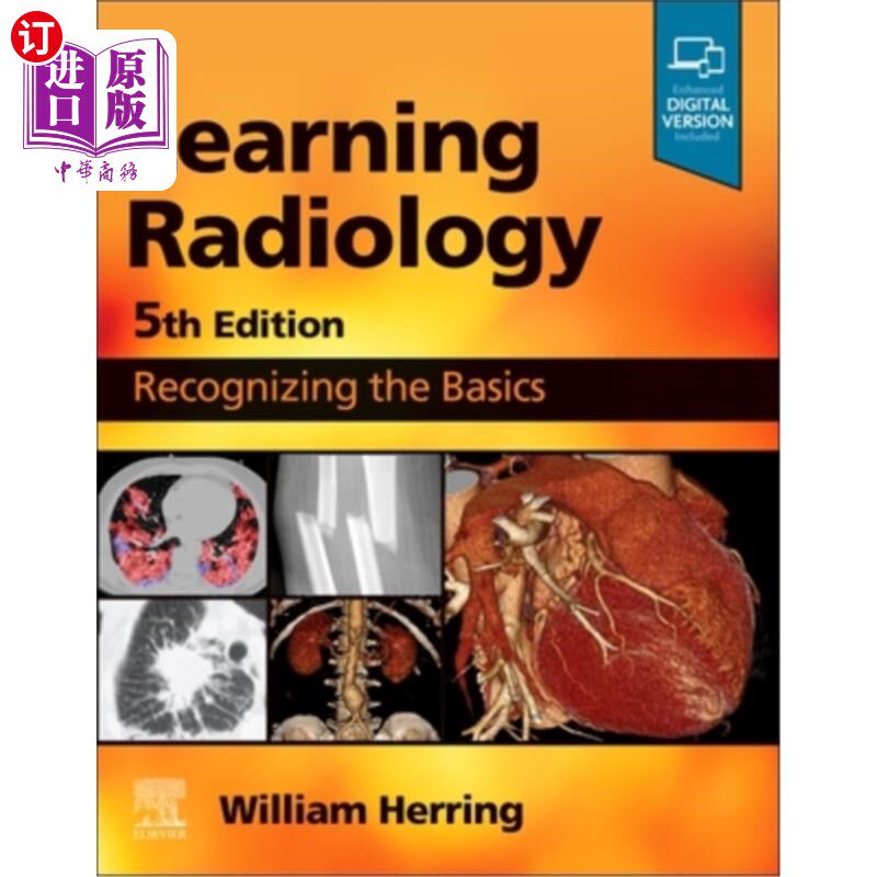 海外直订医药图书Learning Radiology: Recognizing the Basics 学习放射学:认识基础知识