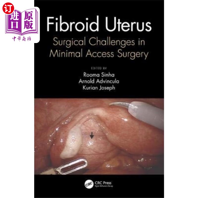 海外直订医药图书Fibroid Uterus 子宫肌瘤